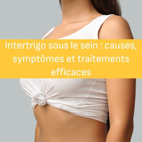 Le blog Storm, des images à couper le souffle.